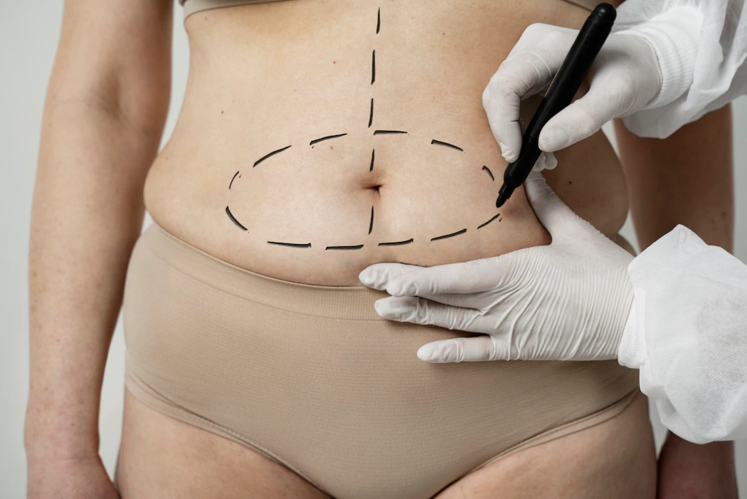 What Is Obesity Surgery?
