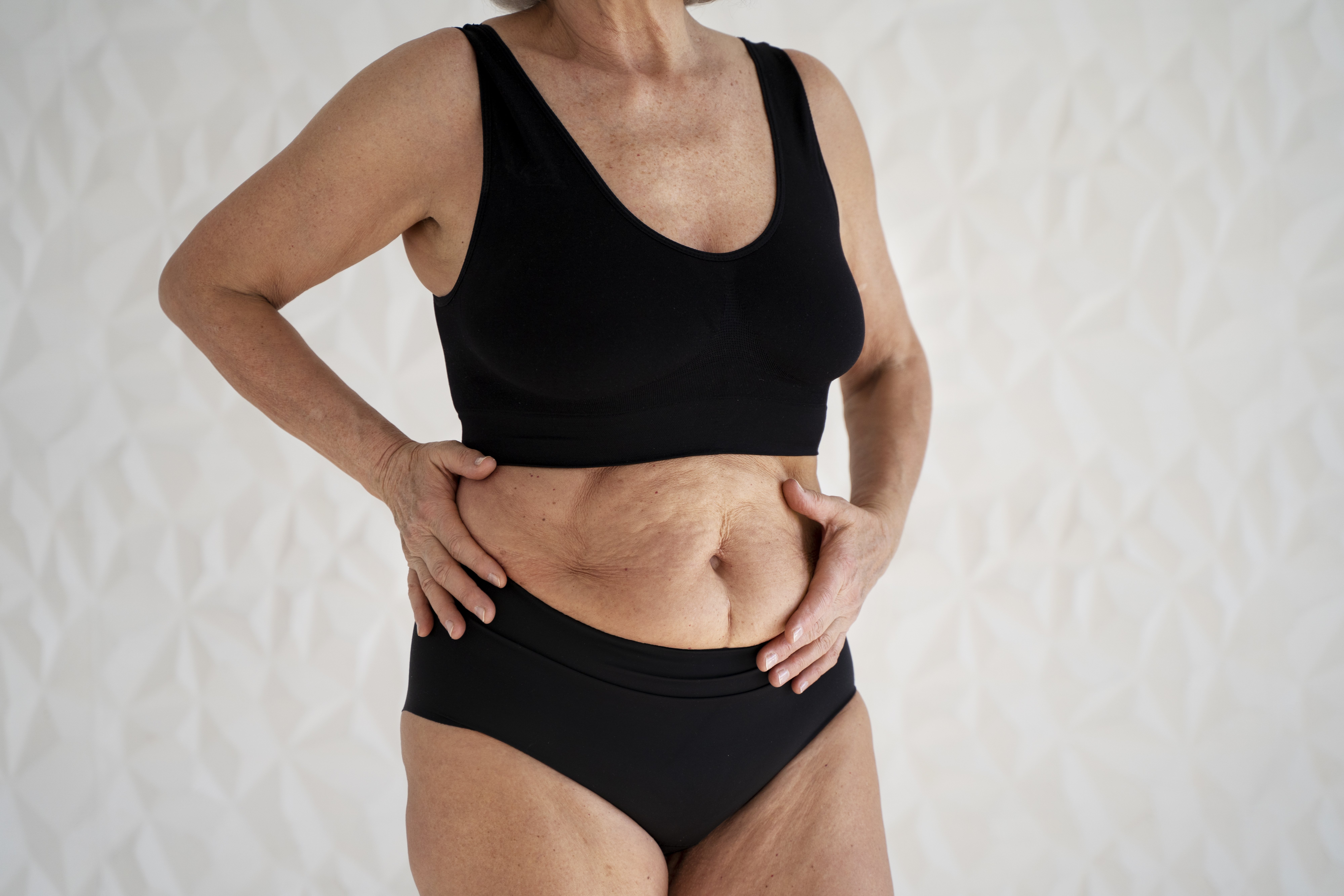 What Are The Features Of Tummy Tuck?